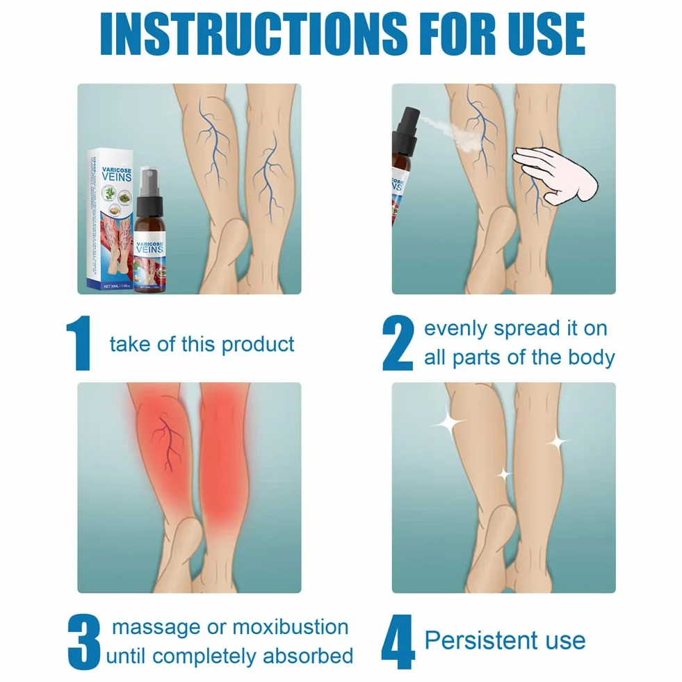 Spray Calmante para Venas Varicosas, Tratamiento de Varices, Alivio Dolor Pierna Circulación Sanguínea