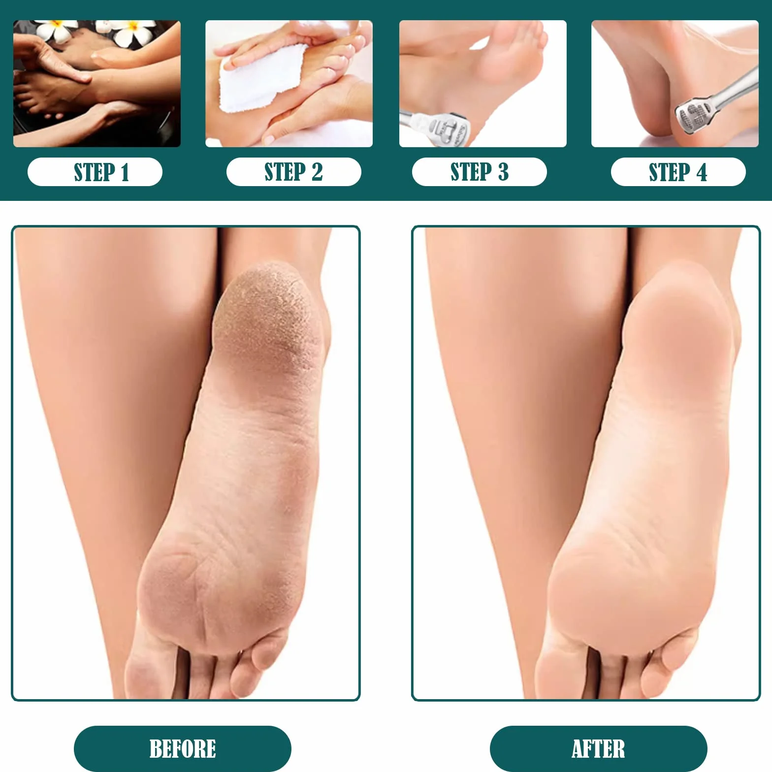Pedicura Lima para Pies Profesional Raspador con 10 Cuchillas Removedor de Callos