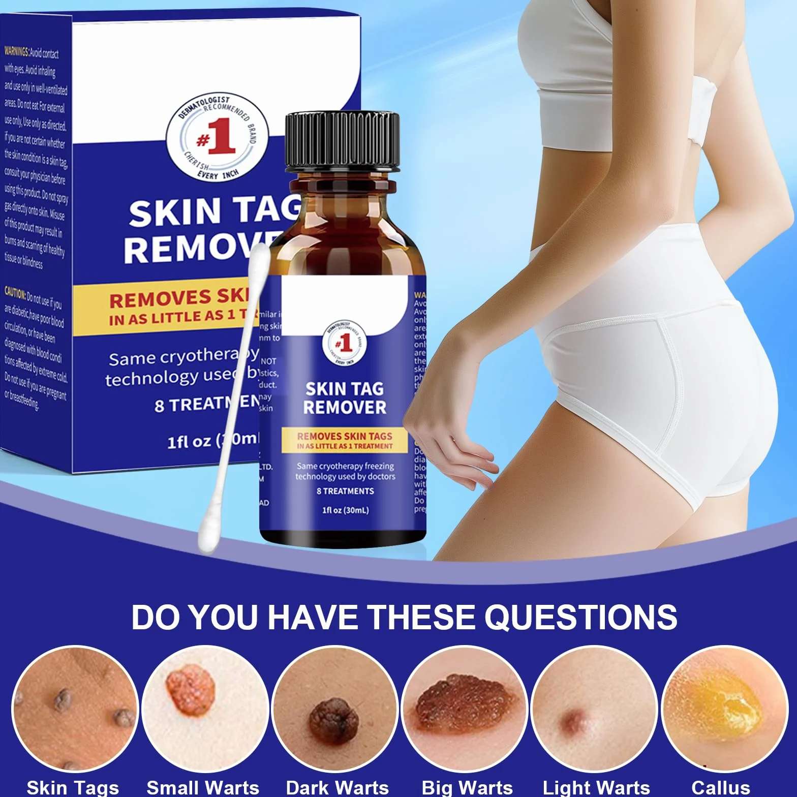 Suavemente Skin Tag Remover 30ml Quitar Verrugas Comunes Fórmula Suave