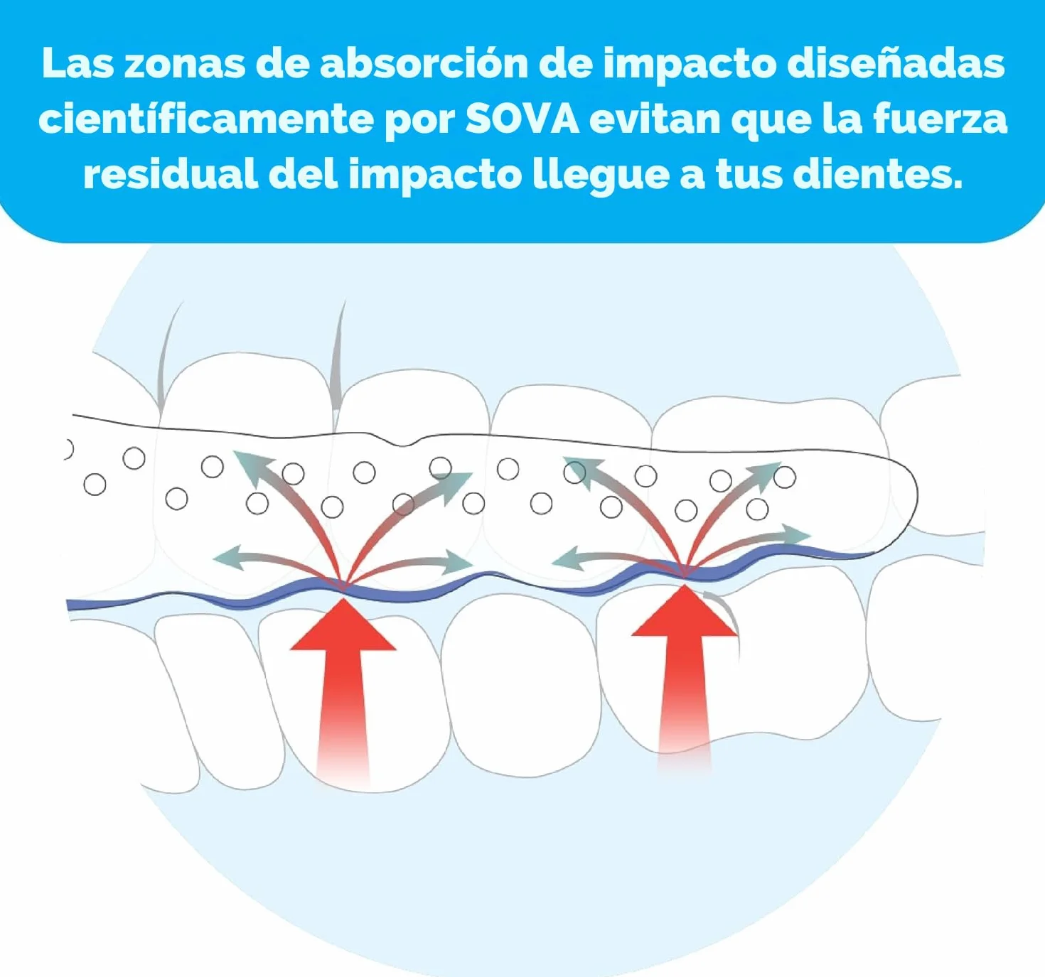 Protector Nocturno SOVA Aero Férula para Bruxismo 1.6mm Adaptable Remoldeable Adultos Estuche
