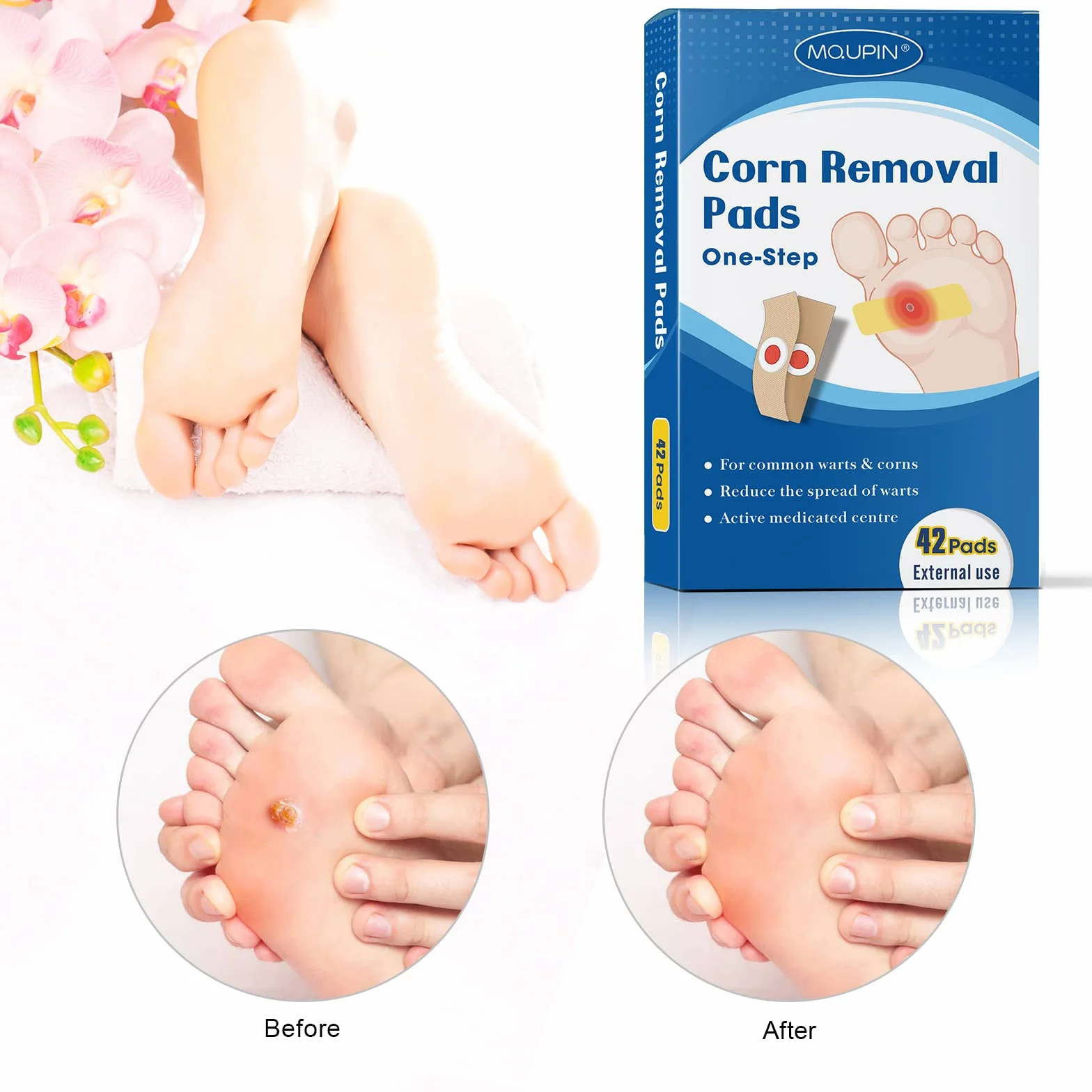 MQUPIN Wart Remover, Eliminar Verrugas, Removedor de Verrugas, Tratamiento para Quitar Verrugas Comunes, Plantares, Maíz y Callos (42pcs)