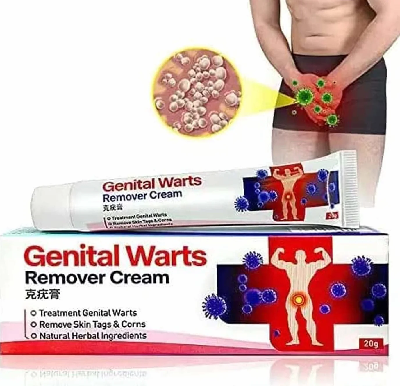 Remover Wart Ointment Genital Vulva Condyloma Acuminatum Treatment Cream Plantar (2pcs)