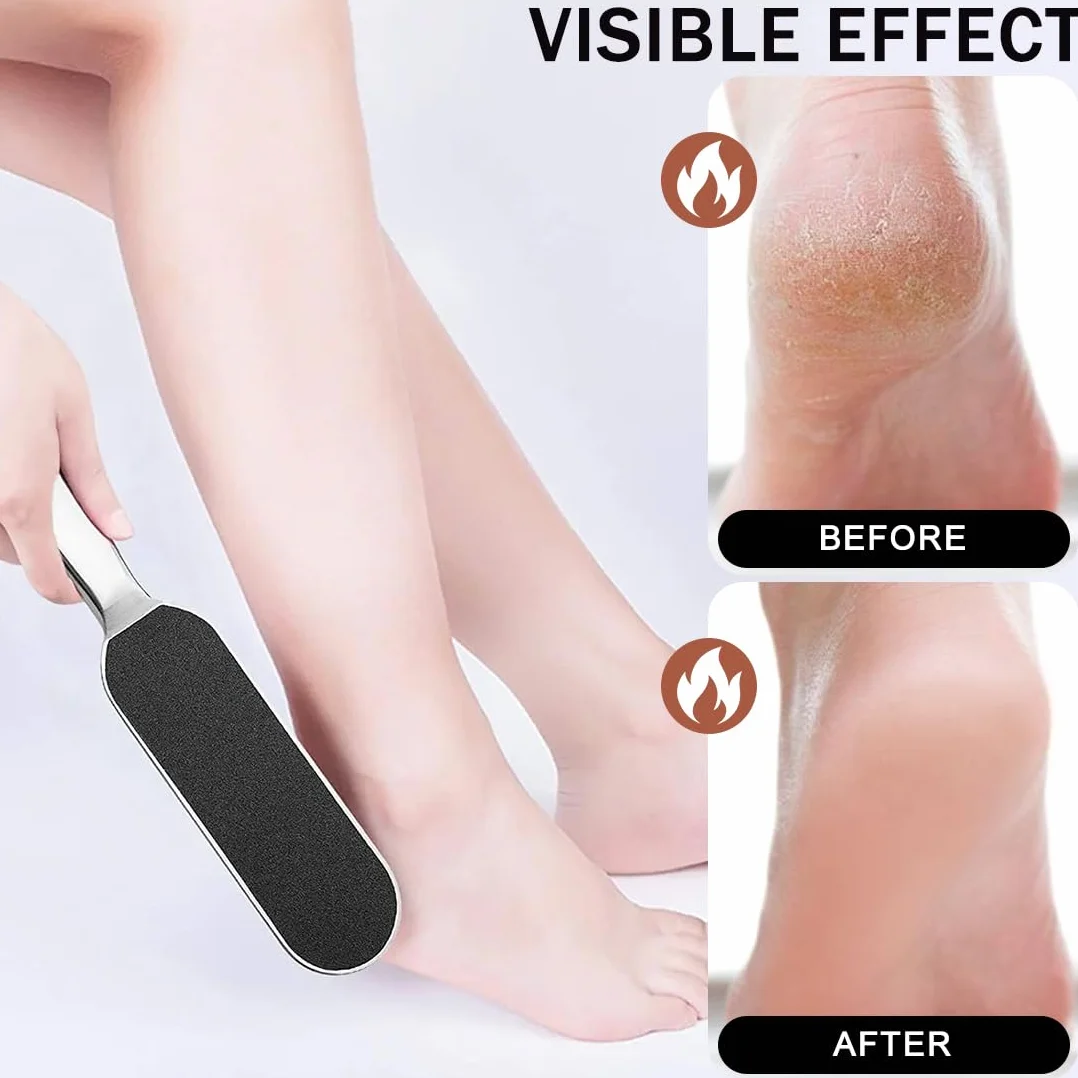 Lima para pies de acero inoxidable con 20 recambios, removedor de callos para pedicura