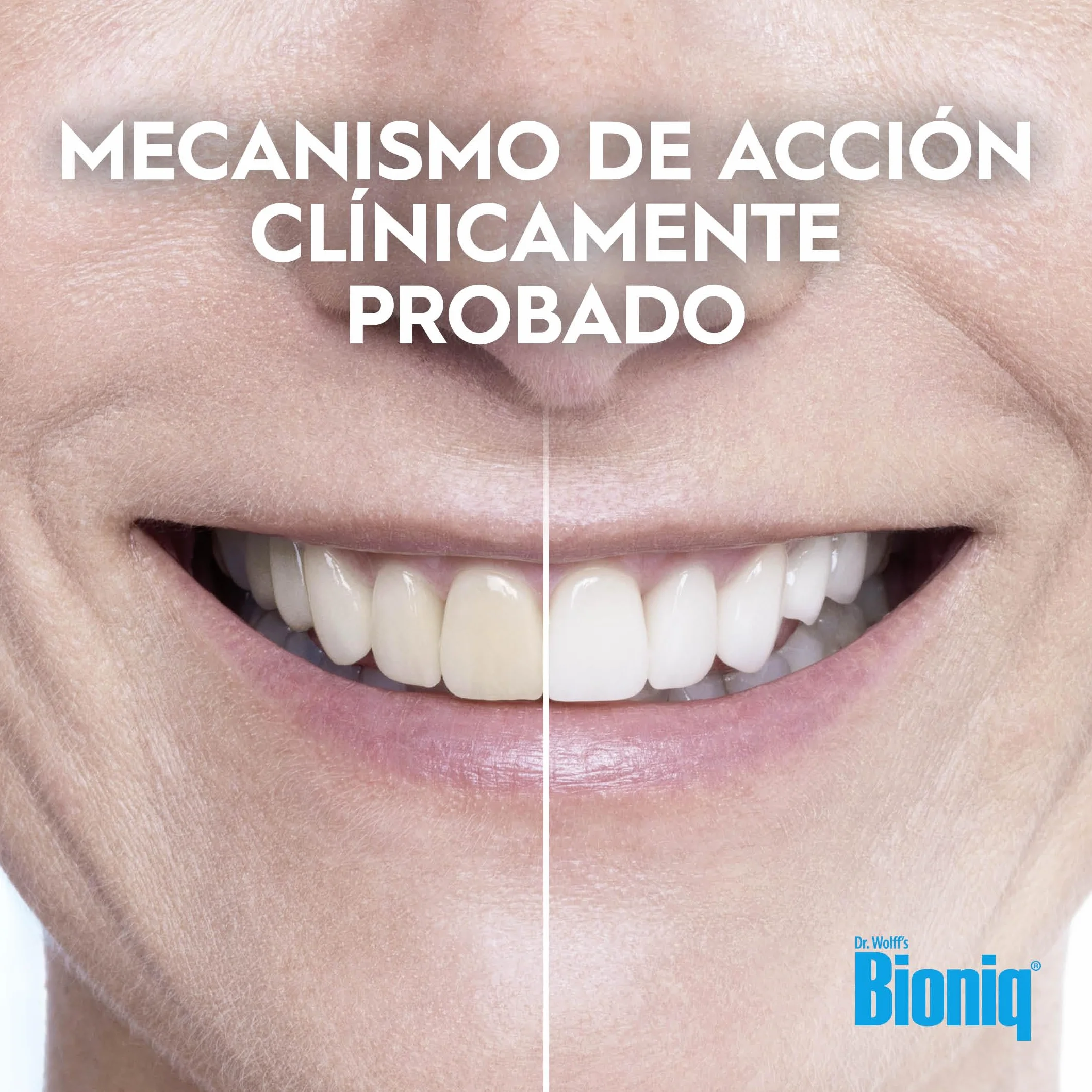Bioniq® White Filler Pasta dental blanqueadora 100 ml con hidroxiapatita sin flúor