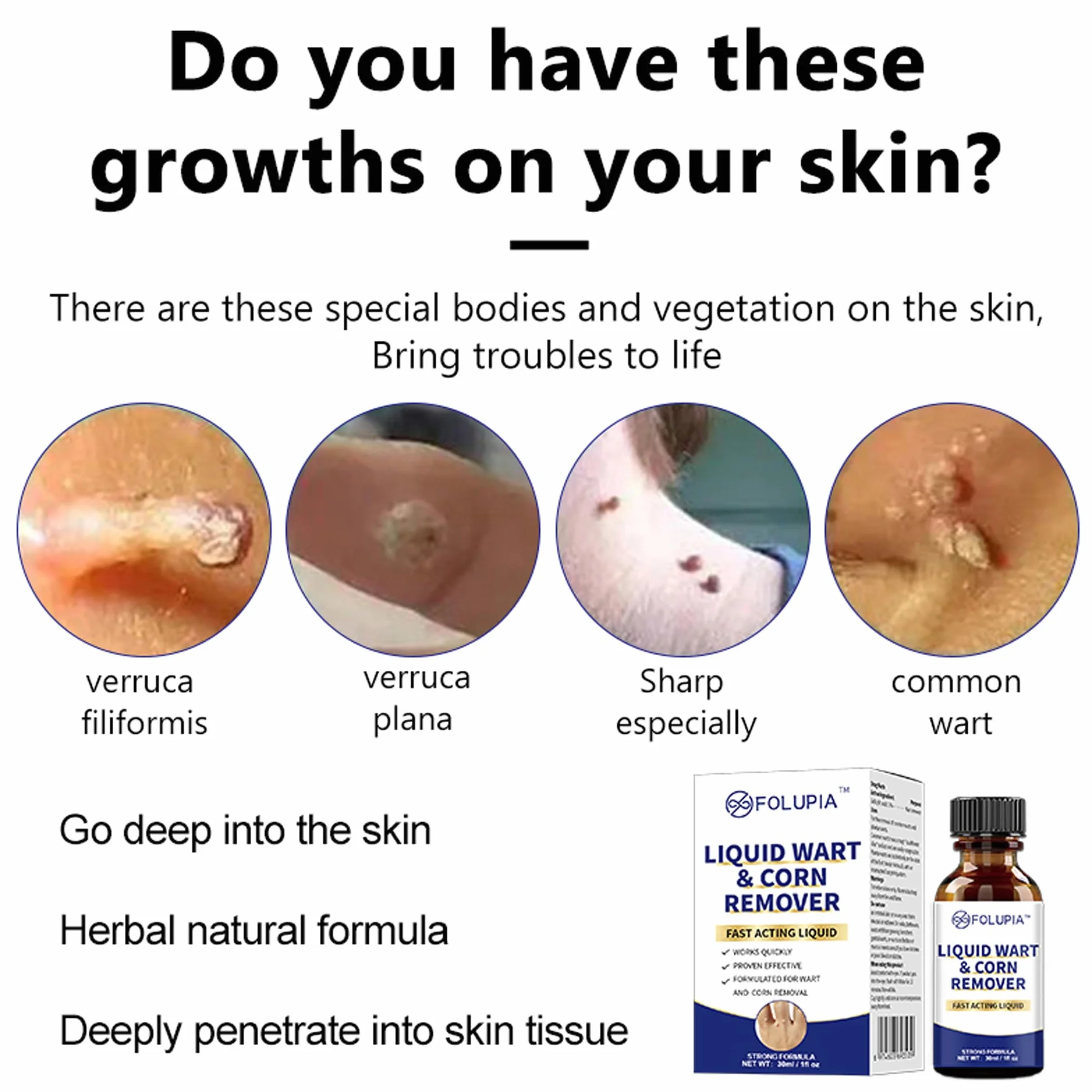 Eliminador de verrugas y lunares 30ml líquido para cuerpo y manos