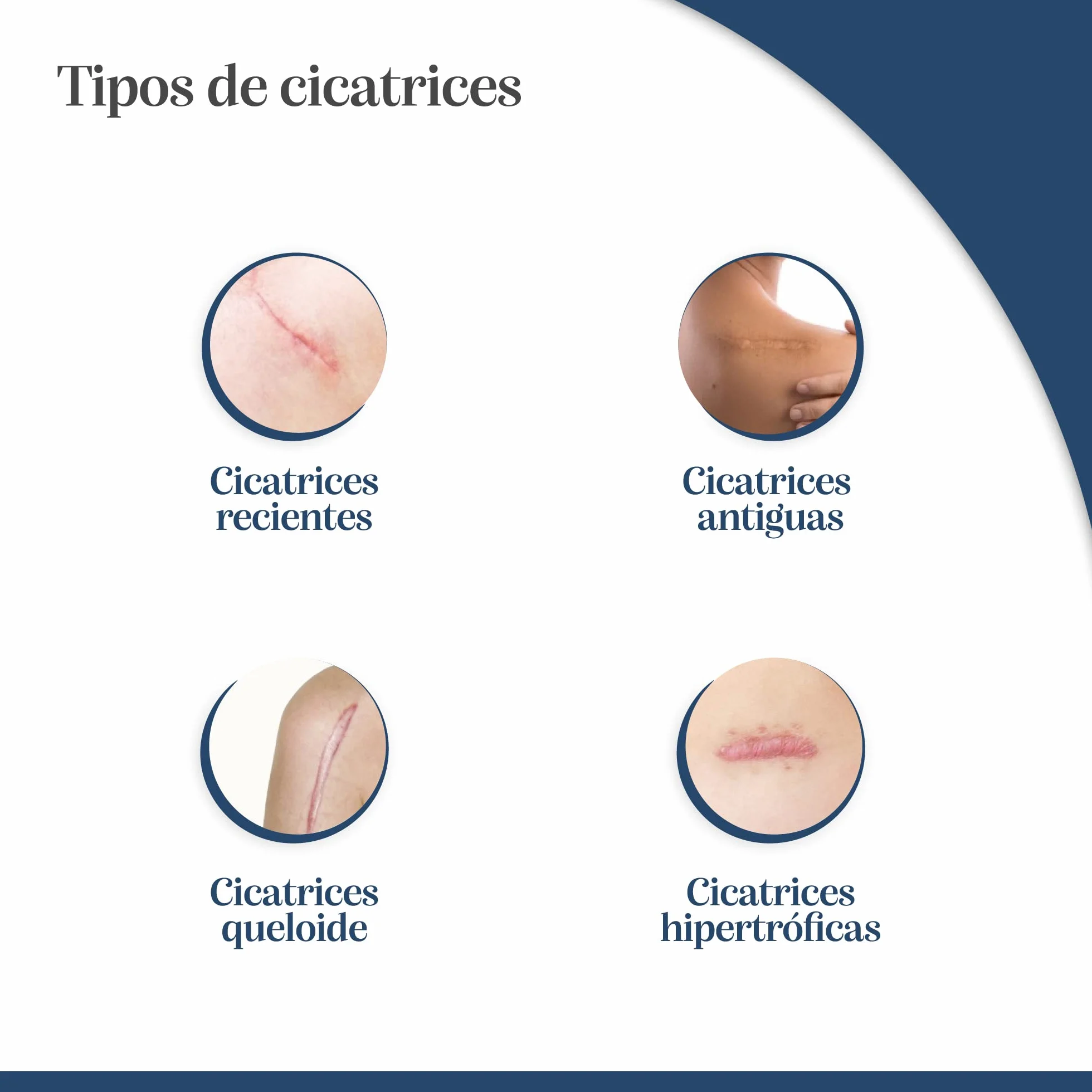 Trofolastin Reductor de Cicatrices Apósitos Adhesivos 5x7,5cm 5 Unidades