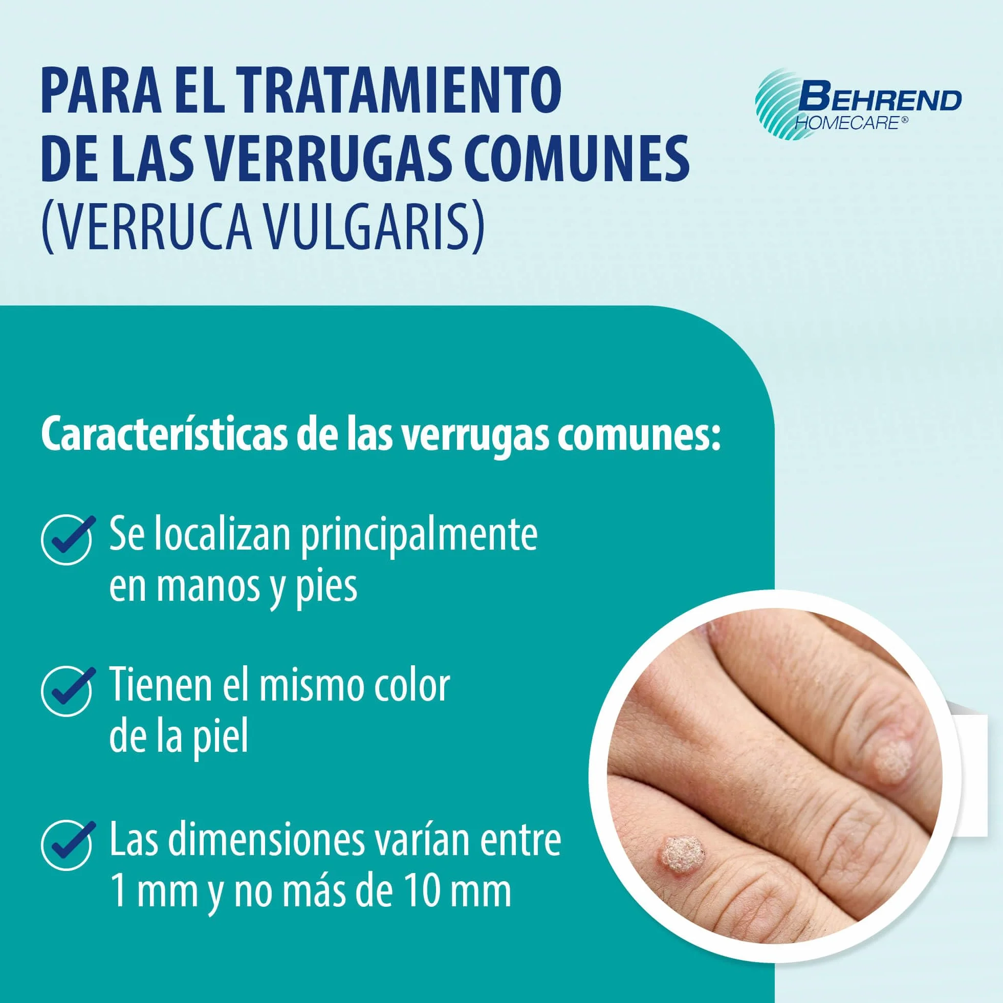 Behrend Contra las verrugas manos pies preciso indoloro seguro niños 4 años 2 ml