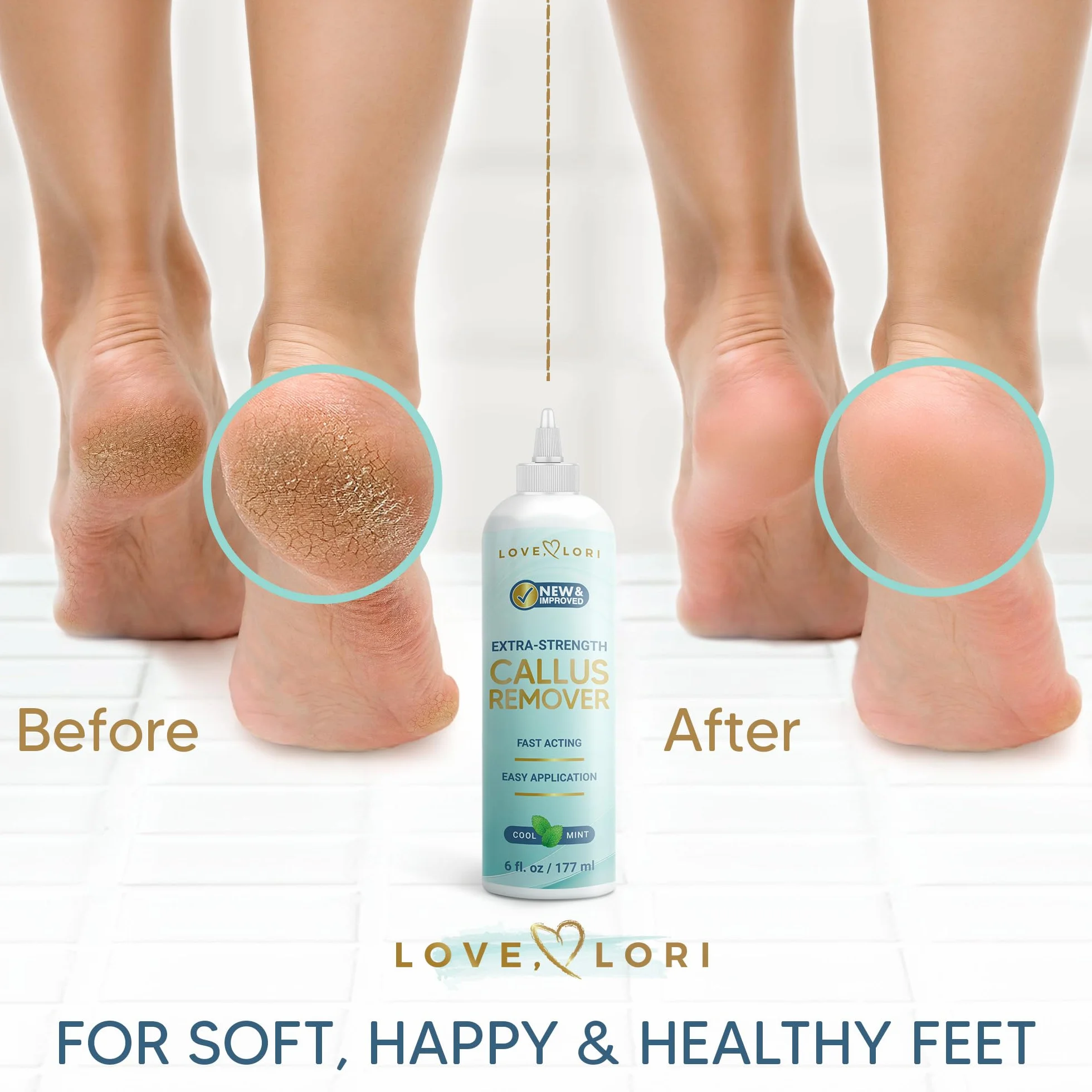 Removedor de Callos para Pies Extra Fuerte Gel 6 oz