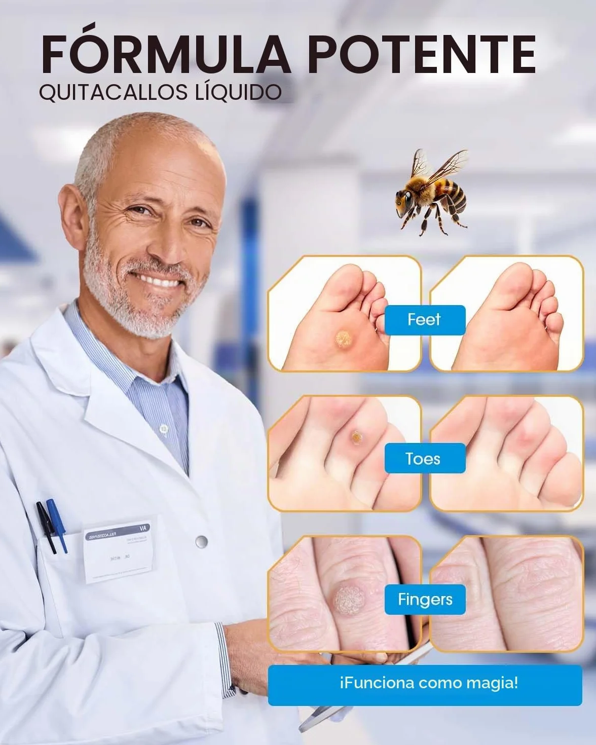 Removedor de Maíz con Veneno de Abeja 20 ml Máxima Potencia Eliminador de Callos Líquido para Pies
