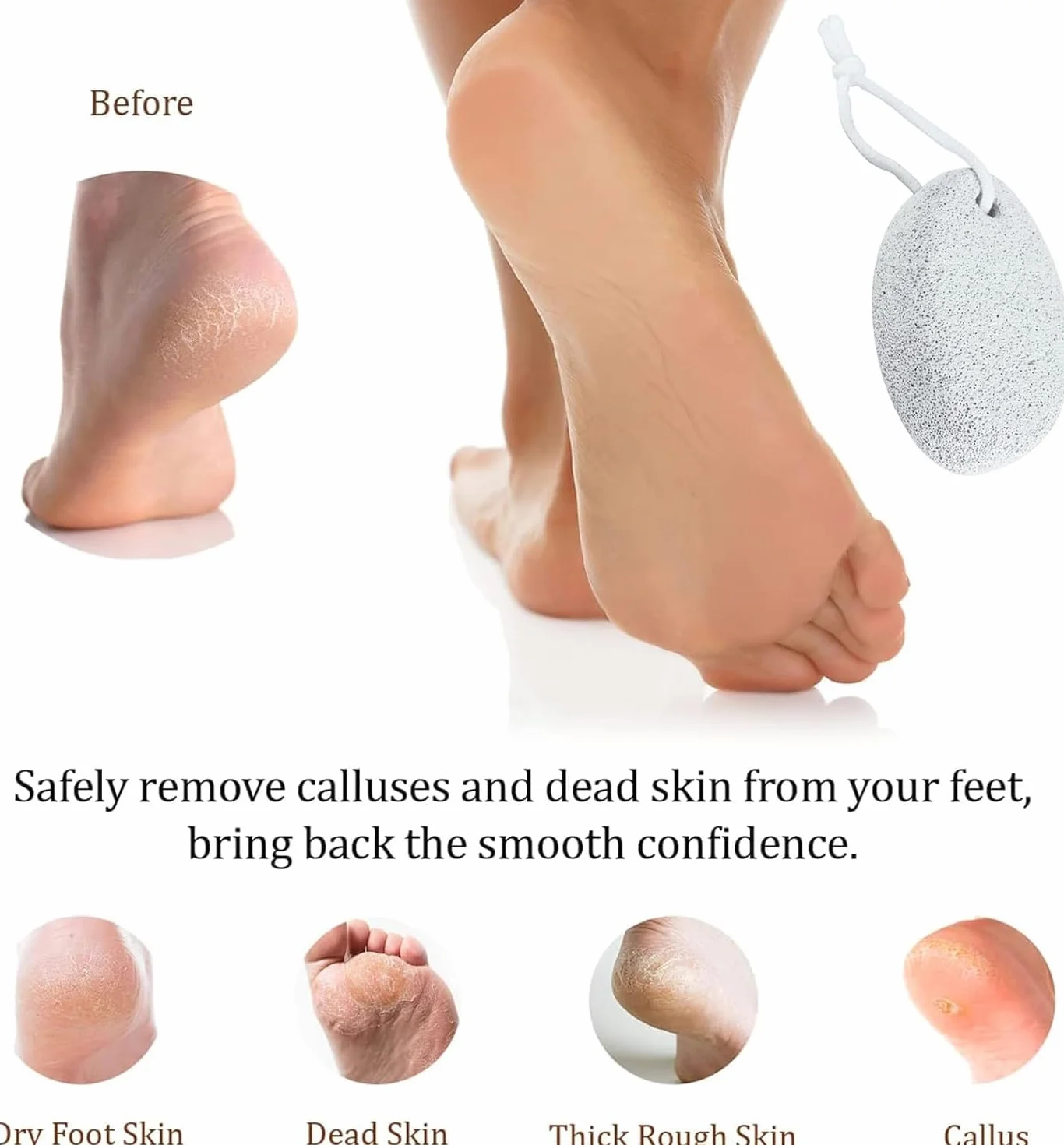 Piedra Pómez Natural para Pies 2 Piezas, Exfoliante Eliminar Piel Muerta Pedicura Herramienta