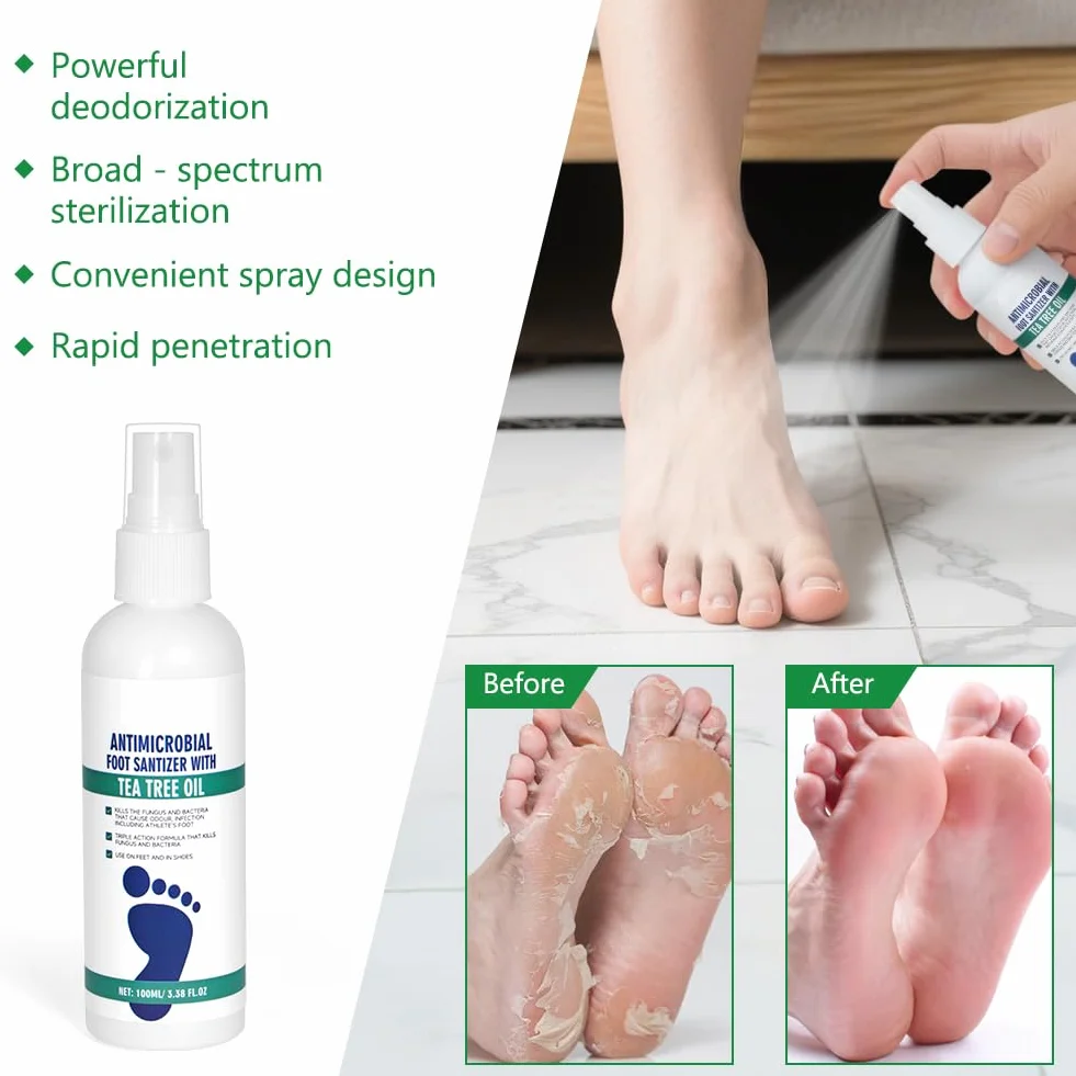 AOOWU Spray Purificante de Pies Fungicida Antiséptico para Micosis y Control de Olor