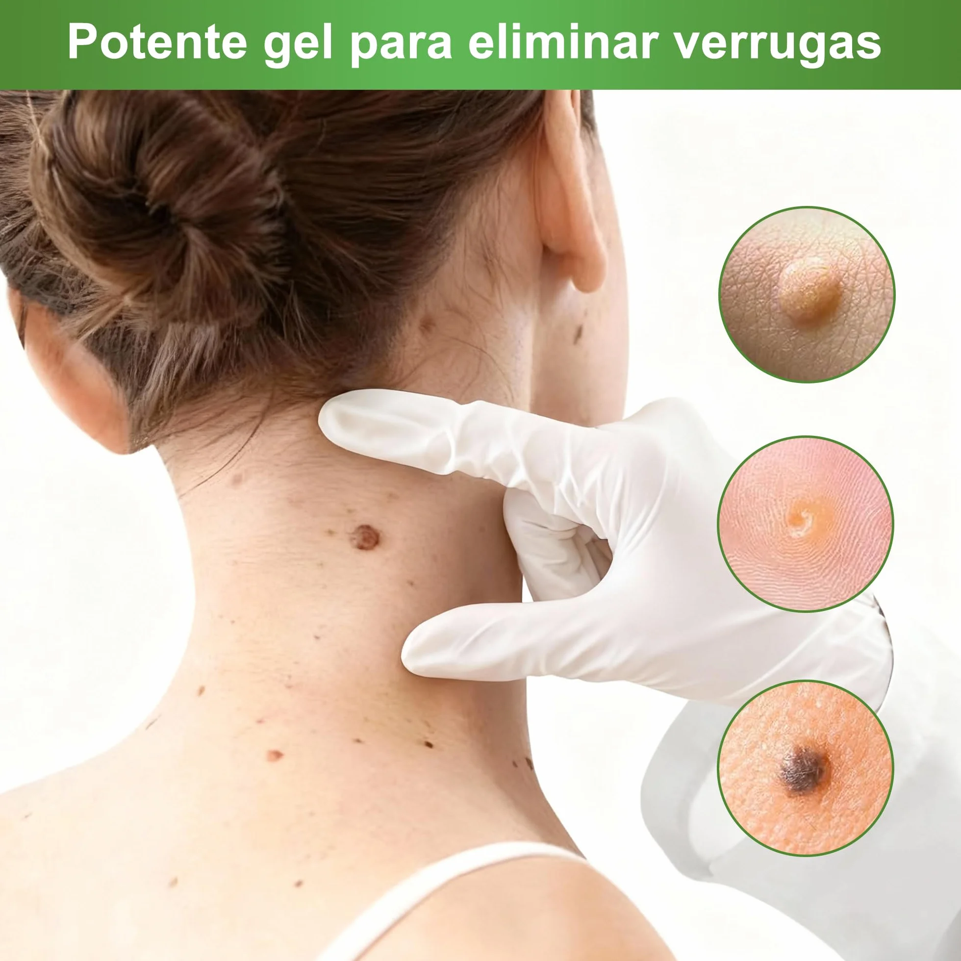 Gel Quita Verrugas
