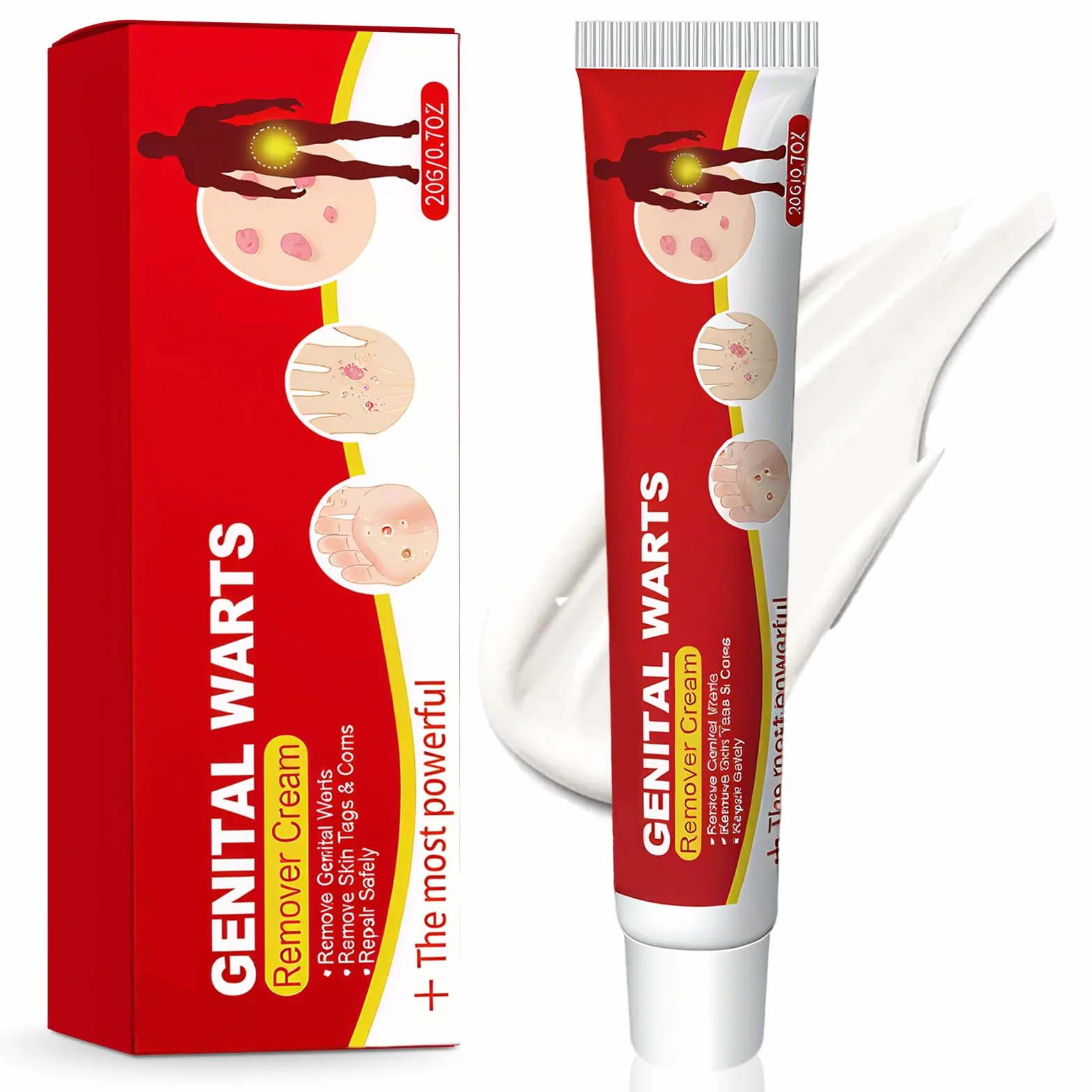 Crema Eliminador De Verrugas Piel 20g